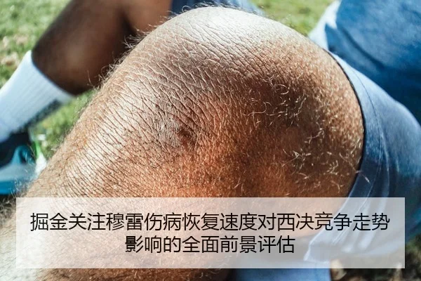 掘金关注穆雷伤病恢复速度对西决竞争走势影响的全面前景评估